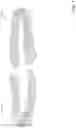 Fig. 02 - Apparatus and methods for orthodontic treatment planning