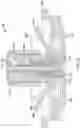 Fig. 35 - Fluid delivery apparatus having a gas extraction device and method of use