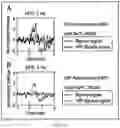 Fig. 17 - Systems, methods and media for detecting and facilitating an effortful mental task by providing real-time deep brain stimulation