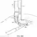 Fig. 44 - Illuminated and modular soft tissue retractor