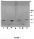 Fig. 02 - SELECTIVE ENRICHMENT OF ANTIBODIES