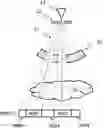 Fig. 01 - Multi-source cone beam computed tomography