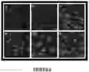 Fig. 07 - Cell-Based Biosensor for Early Alzheimer's Disease Detection