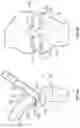 Fig. 04 - Prosthetic knee implant systems and methods with linked tibial rotation
