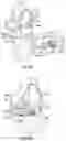 Fig. 10 - Prosthetic knee implant systems and methods with linked tibial rotation