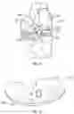 Fig. 13 - Prosthetic knee implant systems and methods with linked tibial rotation
