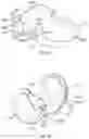 Fig. 14 - Prosthetic knee implant systems and methods with linked tibial rotation