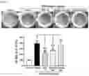 Fig. 02 - Composition for preventing or treating obesity comprising natural mixture extracts