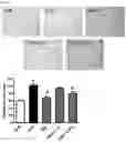 Fig. 07 - Composition for preventing or treating obesity comprising natural mixture extracts