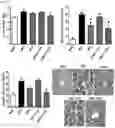 Fig. 09 - Composition for preventing or treating obesity comprising natural mixture extracts