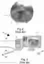Fig. 03 - Method of using a manually-operated light plane generating module to make accurate measurements of the dimensions of an object seen in an image taken by an endoscopic camera