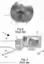 Fig. 08 - Method of using a manually-operated light plane generating module to make accurate measurements of the dimensions of an object seen in an image taken by an endoscopic camera
