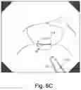 Fig. 11 - Method of using a manually-operated light plane generating module to make accurate measurements of the dimensions of an object seen in an image taken by an endoscopic camera