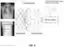 Fig. 10 - Methods and systems for modulating radiation dose