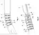 Fig. 06 - ARTICULATION ASSEMBLIES FOR USE WITH ENDOSCOPIC SURGICAL INSTRUMENTS