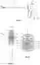 Fig. 11 - ARTICULATION ASSEMBLIES FOR USE WITH ENDOSCOPIC SURGICAL INSTRUMENTS