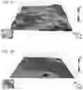 Fig. 02 - Method for treating denture stomatitis using denture base material containing nanodiamonds