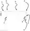 Fig. 02 - PHYSICAL THERAPY DEVICE AND METHOD FOR STRETCHING MUSCLES IN THE FOOT