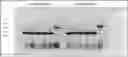Fig. 01 - Enhanced -enterotoxigenic multi-valent vaccine