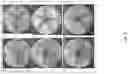 Fig. 03 - Enhanced -enterotoxigenic multi-valent vaccine