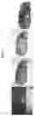 Fig. 02 - Engineered Tissues for in vitro Research Uses, Arrays Thereof, and Methods of Making the Same