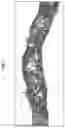 Fig. 08 - Engineered Tissues for in vitro Research Uses, Arrays Thereof, and Methods of Making the Same