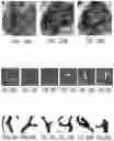 Fig. 43 - NANODIAMOND PARTICLES AND RELATED DEVICES AND METHODS