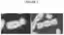 Fig. 02 - Smart microscope system for radiation biodosimetry
