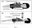Fig. 02 - Diagnostic and therapeutic device for compromised vascular hemodynamics analysis
