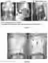 Fig. 02 - METHOD OF ESTIMATION OF THE HEMODYNAMIC STATUS AND CAPACITY OF EFFORT FROM PATIENTS WITH CARDIOVASCULAR AND PULMONAR DISEASES