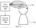Fig. 02 - EPILEPTIC SEIZURE DETECTION WITH EEG PREPROCESSING