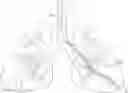 Fig. 01 - BIOPSY NEEDLE FOR ACCESSING PERIPHERAL LUNG NODULES
