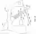 Fig. 17 - Tissue acquisition helix device