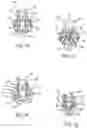 Fig. 06 - Distraction and retraction assembly incorporating locking feature