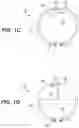 Fig. 04 - Aneurysm treatment device