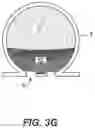 Fig. 09 - Aneurysm treatment device
