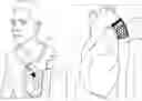 Fig. 01 - ANTENNA FOR USE WITH AN INTRAVASCULAR DEVICE
