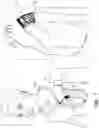 Fig. 02 - ANTENNA FOR USE WITH AN INTRAVASCULAR DEVICE