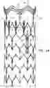 Fig. 03 - ANTENNA FOR USE WITH AN INTRAVASCULAR DEVICE