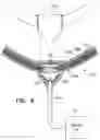 Fig. 12 - ANTENNA FOR USE WITH AN INTRAVASCULAR DEVICE