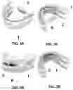 Fig. 02 - BUCCAL VALVE
