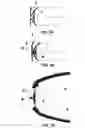 Fig. 03 - BUCCAL VALVE