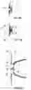 Fig. 06 - BUCCAL VALVE