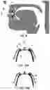 Fig. 07 - BUCCAL VALVE