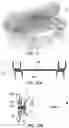 Fig. 08 - BUCCAL VALVE