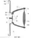 Fig. 09 - BUCCAL VALVE