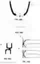 Fig. 11 - BUCCAL VALVE