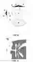 Fig. 14 - BUCCAL VALVE