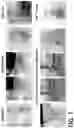 Fig. 02 - Method for culturing 3-dimensional lung cancer organoid and method for preparing patient-derived xenograft animal model using same