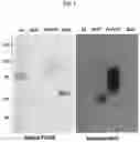 Fig. 02 - Kit for tracking and diagnosing degree of progressive chronic hepatitis and liver fibrosis by measuring asialo (alpha)1-acid glycoprotein as hepatocellular injury marker and use thereof